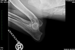 vroni_ed_kw25-40-_rechts_04